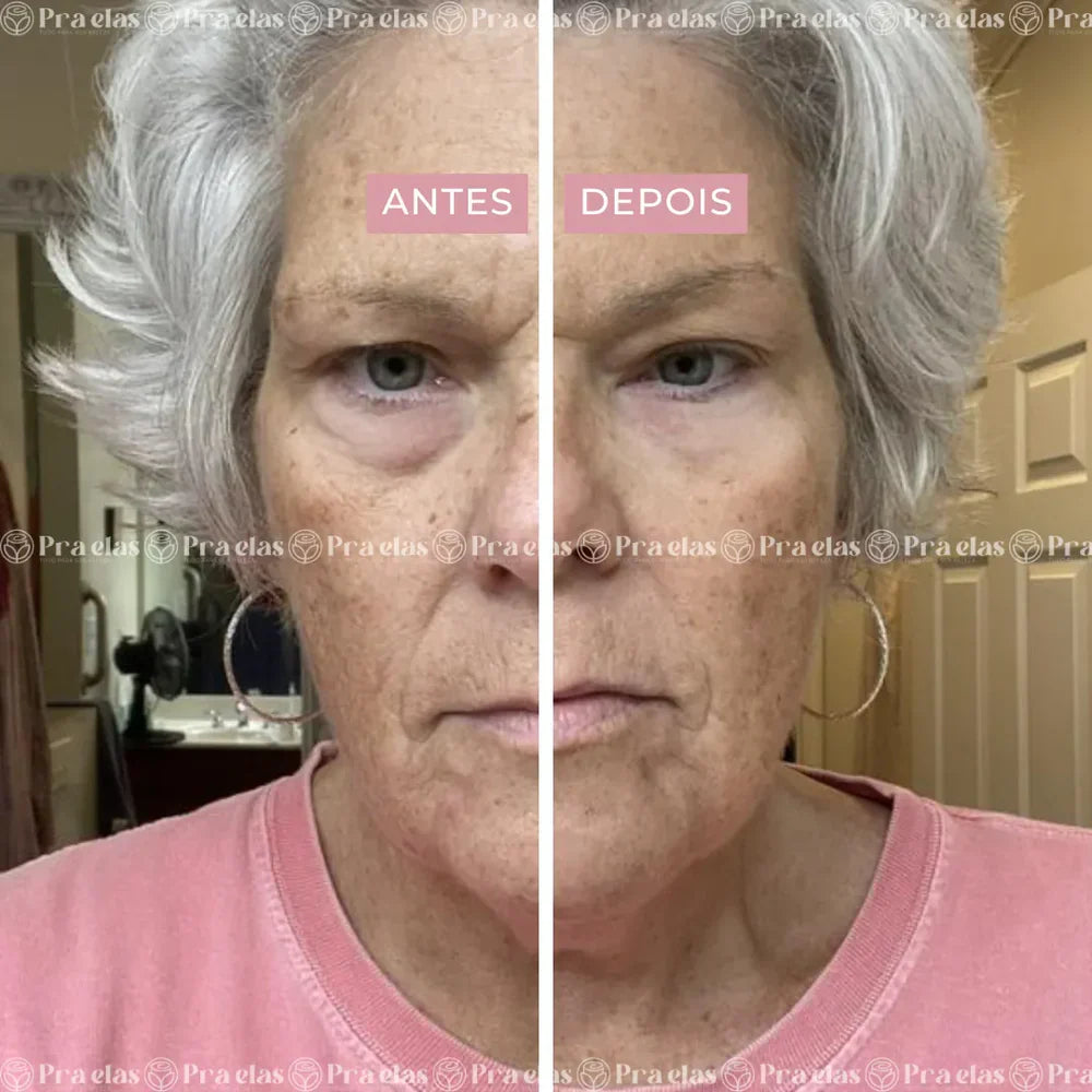 Creme Antirrugas Instantâneo - (Compre 1 Leve 2) ®