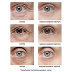 Creme Antirrugas Instantâneo - (Compre 1 Leve 2) ®